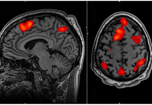 fmri_scan_during_working_memory_tasks